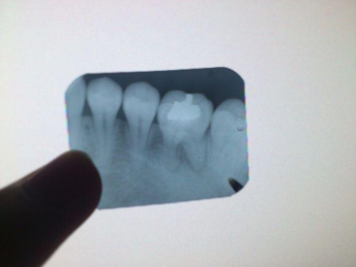 thumb_1678946916_720_540.jpg